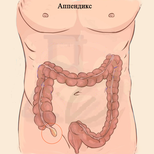 Аппендикс Аппендикс