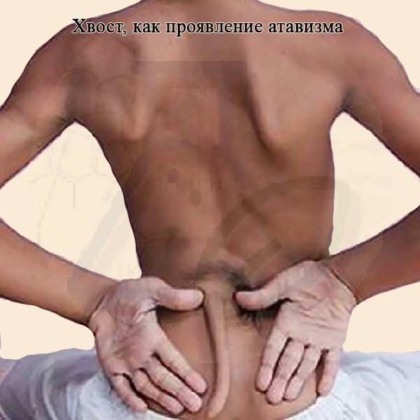 Хвост – проявление атавизма у человека Хвост – проявление атавизма у человека